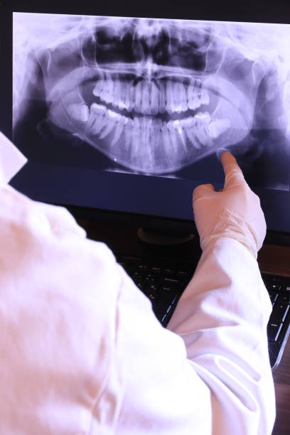 Best Emergency Dentist for Knocked-Out Tooth in Point Roberts, WA
